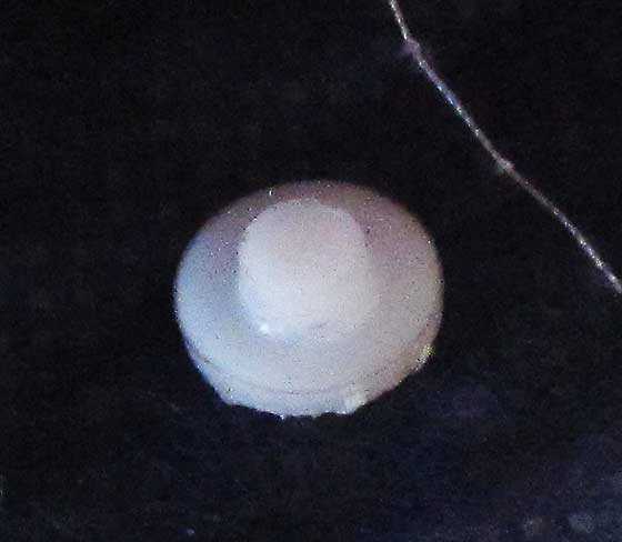 button